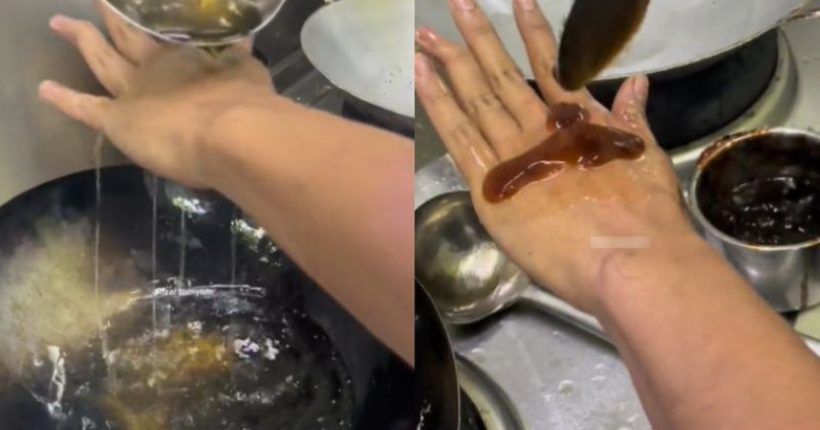 Adakah Kicap Berkesan Merawat Lecur Kulit