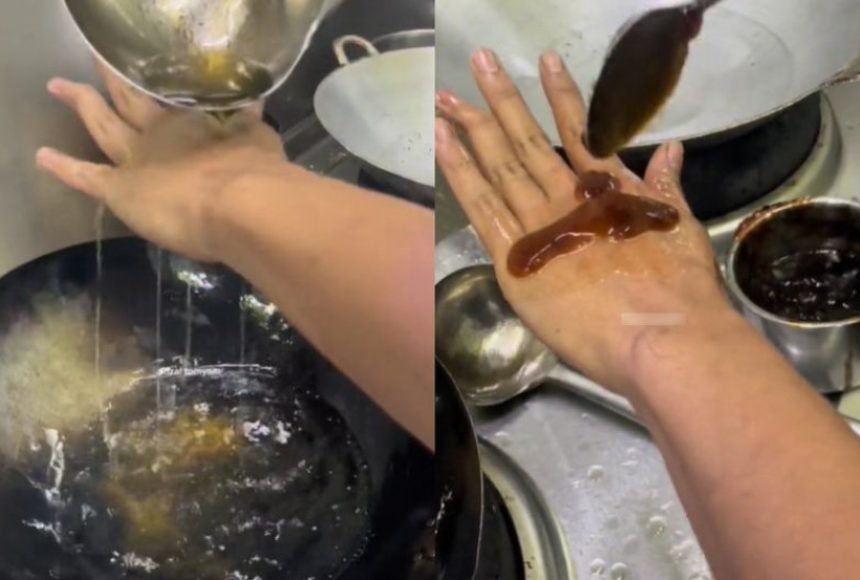 Adakah Kicap Berkesan Merawat Lecur Kulit
